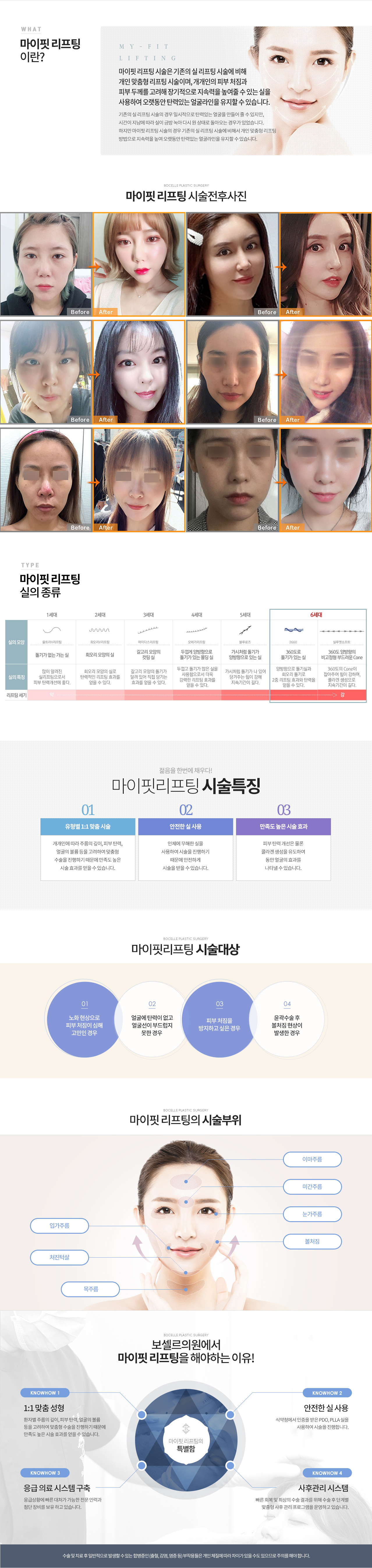 세븐업리프팅컨텐츠